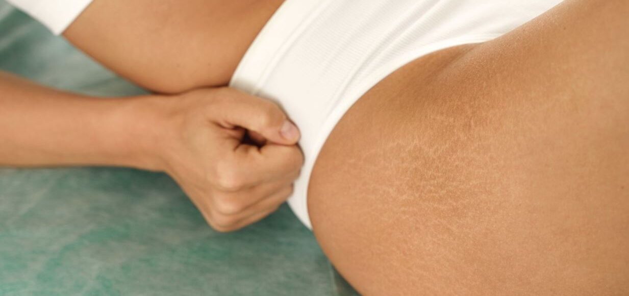 Uromed